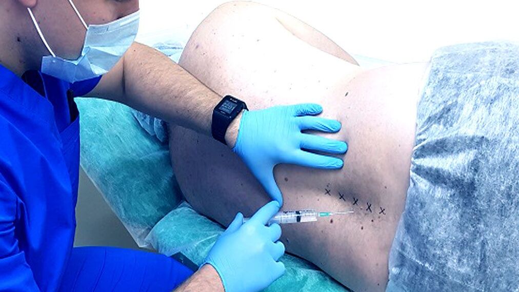 Gerincblokk az osteochondrosishoz