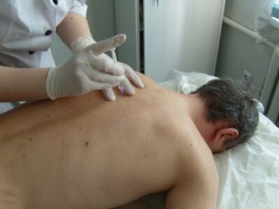 Kondroprotektorok intraartikuláris injekciói mellkasi osteochondrosishoz